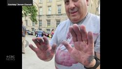 Winnipegger fights hate by removing antisemitic, other offensive graffiti News Clip