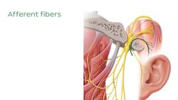 Accessory nerve Instructional Video