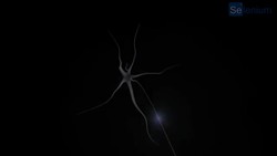 Trastorno especifico del lenguaje ( TEL ) Instructional Video