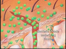 The Human Body Major Systems & Organs - How The Skin Protects Us Instructional Video