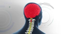 Researchers use new method to help paralyzed patients walk again Instructional Video