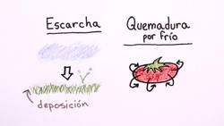 ¿Qué son las quemaduras por frío? Instructional Video