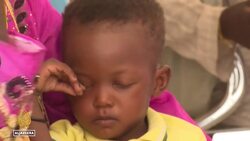 Malnutrition in Sudan: Hunger on the rise among Sudanese children News Clip