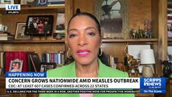 Concern grows nationwide amid meales outbreak News Clip