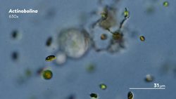 Suctorians: The Ugly Duckling of Ciliates Instructional Video