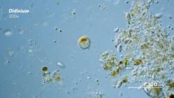 Didinium The Paramecium Hunter Instructional Video