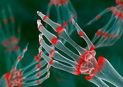 Autoimmune disease Instructional Video