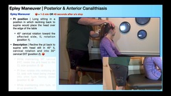 BPPV Treatment | Epley Maneuver [Why, When, & How] Instructional Video