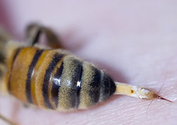 Bee Stings Instructional Video