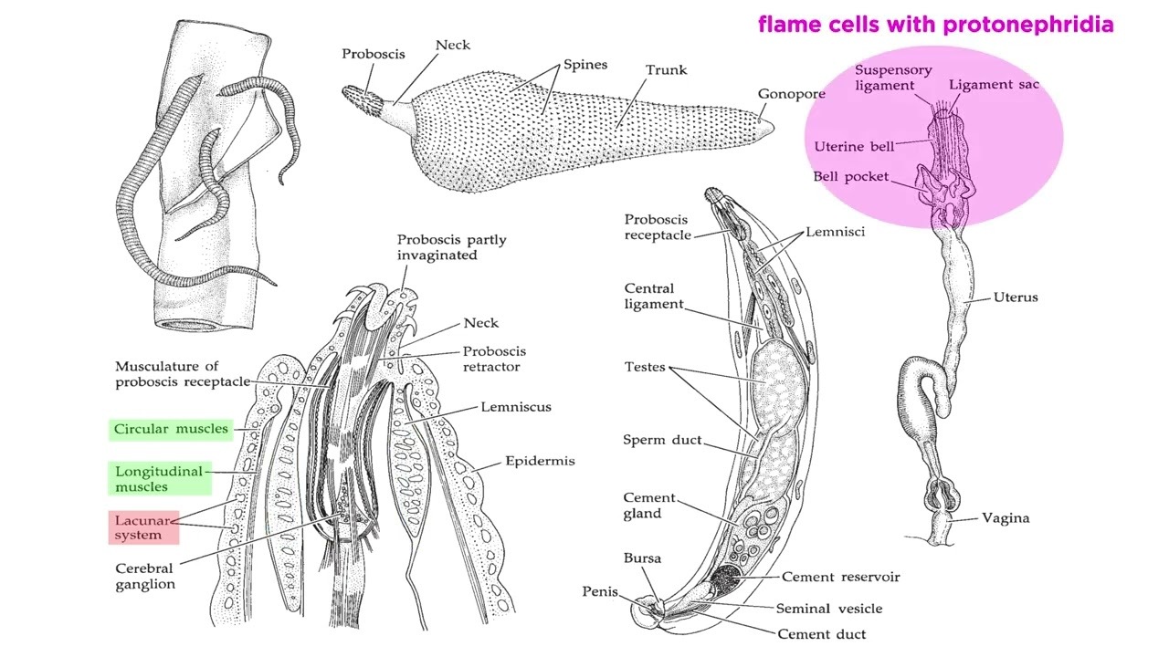 Phylum Rotifera Part 3: Subclade Acanthocephala (Parasitic Spiny-Headed ...