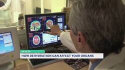 Are you drinking enough water? Here's why doctors say it's important to stay hydrated News Clip