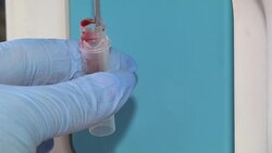 Apparatus for blood analysis. Blood chemistry. Evaluation of a general blood test. Stock Footage