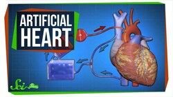 The Key to an Artificial Heart ... and Open-Heart Surgery Instructional Video