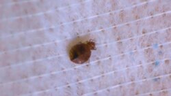 What Is a Bed Bug? Instructional Video
