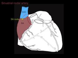 Coronary circulation of the heart Instructional Video