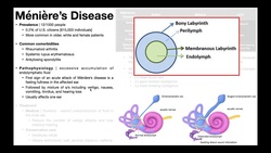 👂 Ménière’s Disease | Presentation, Pathophysiology, Diagnosis & Treatment Instructional Video