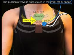Sternal angle Instructional Video