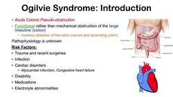 Ogilvie Syndrome | Pseudo-Obstruction of the Large Intestine: Causes, Symptoms, Diagnosis, Treatment Instructional Video