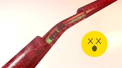 Main arteries of the trunk Instructional Video