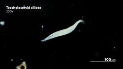 The Chaotic Life of Seashore Ciliates Instructional Video