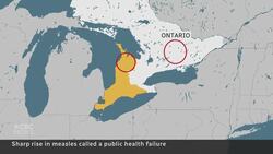 Ontario measles cases more than double in 2 weeks News Clip