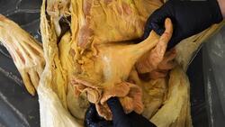 What Energy Drinks Do to the Body Instructional Video