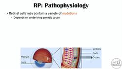 Retinitis Pigmentosa | Genetics, Pathophysiology, Signs & Symptoms, Diagnosis, Treatment Instructional Video