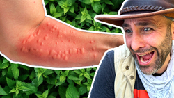 STUNG by a Costa Rican Bush! Instructional Video