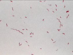 Prokaryotes: Characteristics of Prokaryotes Instructional Video