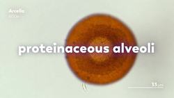 Testate Amoebas: Blobby, Modest Shell Dwellers Instructional Video