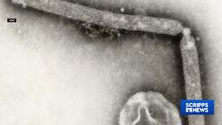 3rd person in US tests positive for bird flu amid dairy cattle outbreak News Clip