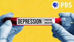 A Blood Test That Can Diagnose Depression? Instructional Video