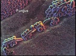 The Human Body Major Systems & Organs - The Immune System And Lymphatic System Instructional Video