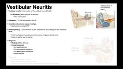 👂 Vestibular Neuritis | Presentation, Pathophysiology, Diagnosis & Treatment Instructional Video