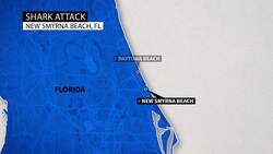 Multiple people injured after shark attacks in Texas and Florida on Fourth of July News Clip