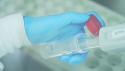 1st plant-based vaccine for humans can be adapted for variants, Medicago says News Clip