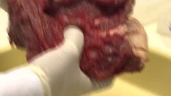 CLEAN : Brazil: JBS accused of "laundering" cattle from deforestation News Clip