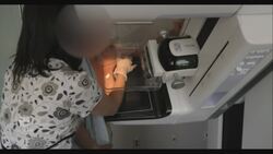 3D Mammogram News Clip