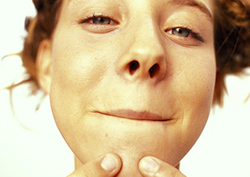 Factpack: Why Do Teens Get Spots? Instructional Video