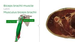 Cross sections of the upper extremity: Arm level Instructional Video