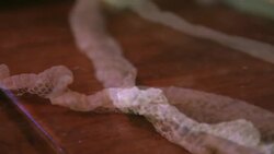 Why Snakes Shed Their Skin Instructional Video