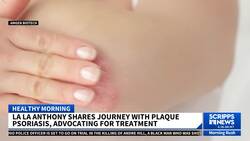 La La Anthony Speaks Out On Living with Plaque Psoriasis and Its Misconceptions News Clip