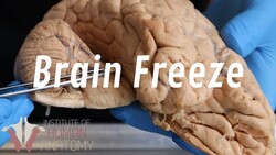 What Is a Brain Freeze?? Instructional Video
