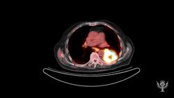 Radioactive Tracers Instructional Video
