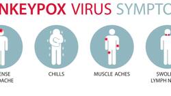 Monkeypox Explained Instructional Video