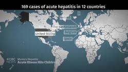 Cause of rare liver disease outbreak in kids a mystery to experts News Clip