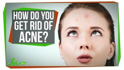 How Do You Get Rid of Acne? Instructional Video