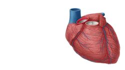 Arteria coronaria sinistra Instructional Video