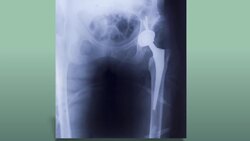 Advances in Technology and Body Repair Instructional Video