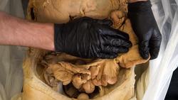 The Truth About Toxic Poop: Debunking the Myths Instructional Video